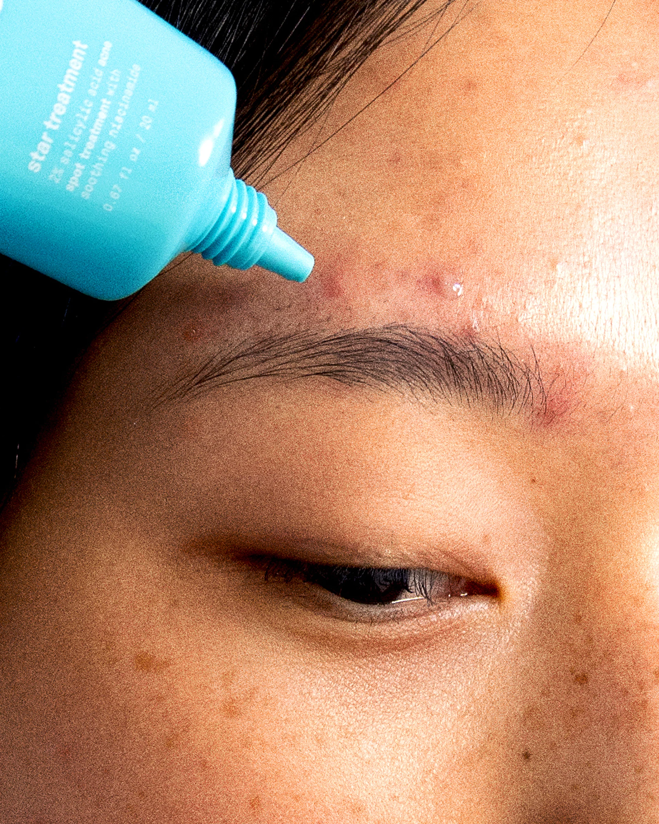 star treatment™ + hydro-star® clear bundle - Image 5